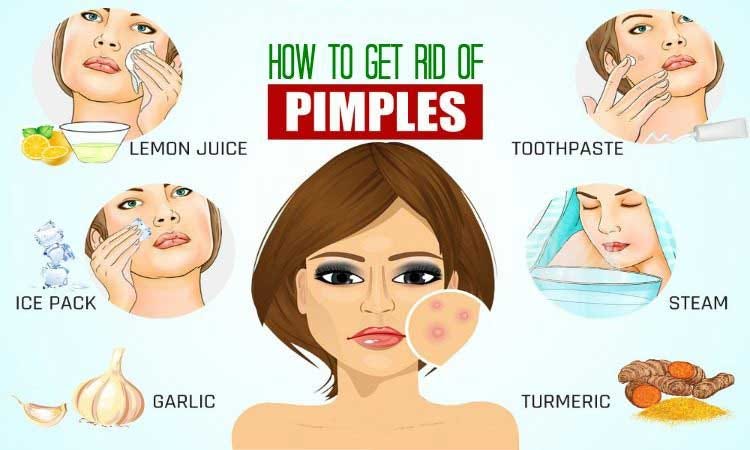 How To Get Rid Of Pimples Overnight For Oily Skin | by Adam Farris | Medium