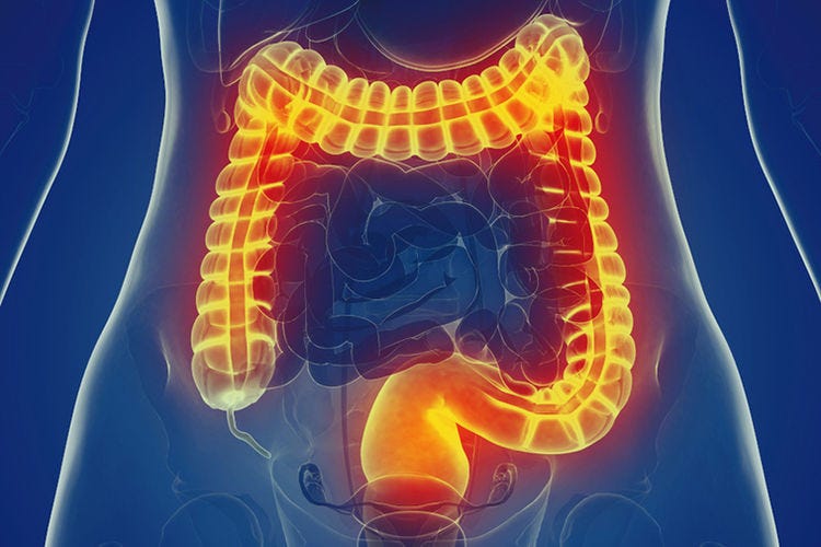 GUT HEALTH 101 IBS, GLUTEN, LEAKY GUT AND FODMAPS by Dr. Jules Cormier Medium