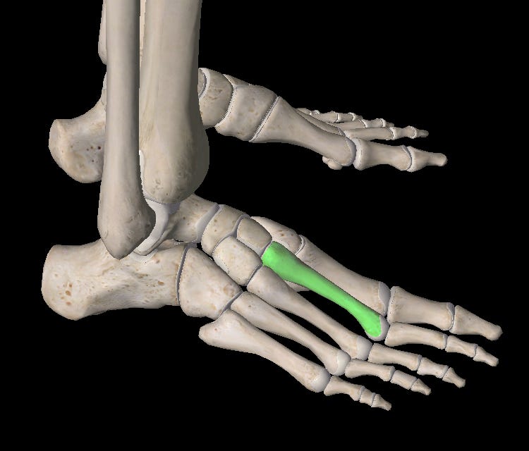 Metatarsalgia. The metatarsals are five long bones… by The Long Haul