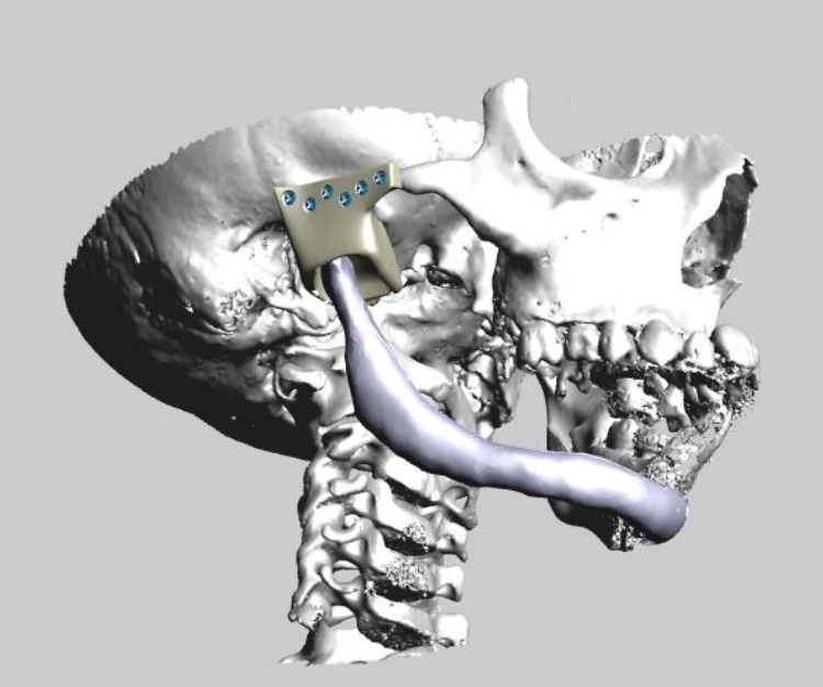 3DHEALS Influencer Interview: Dr. Pedro Martinez Seijas, Oral and  Maxillofacial Surgeon at Donostia University Hospital | by 3DHEALS |  3DHEALS: Healthcare 3D Printing Facts, Opinions, and Stories | Medium