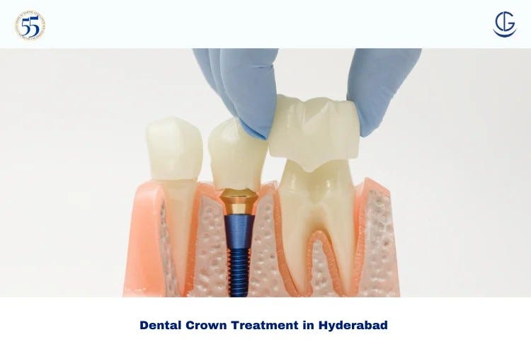 Dental Crowns: A Reliable Solution for Restoring Damaged Teeth