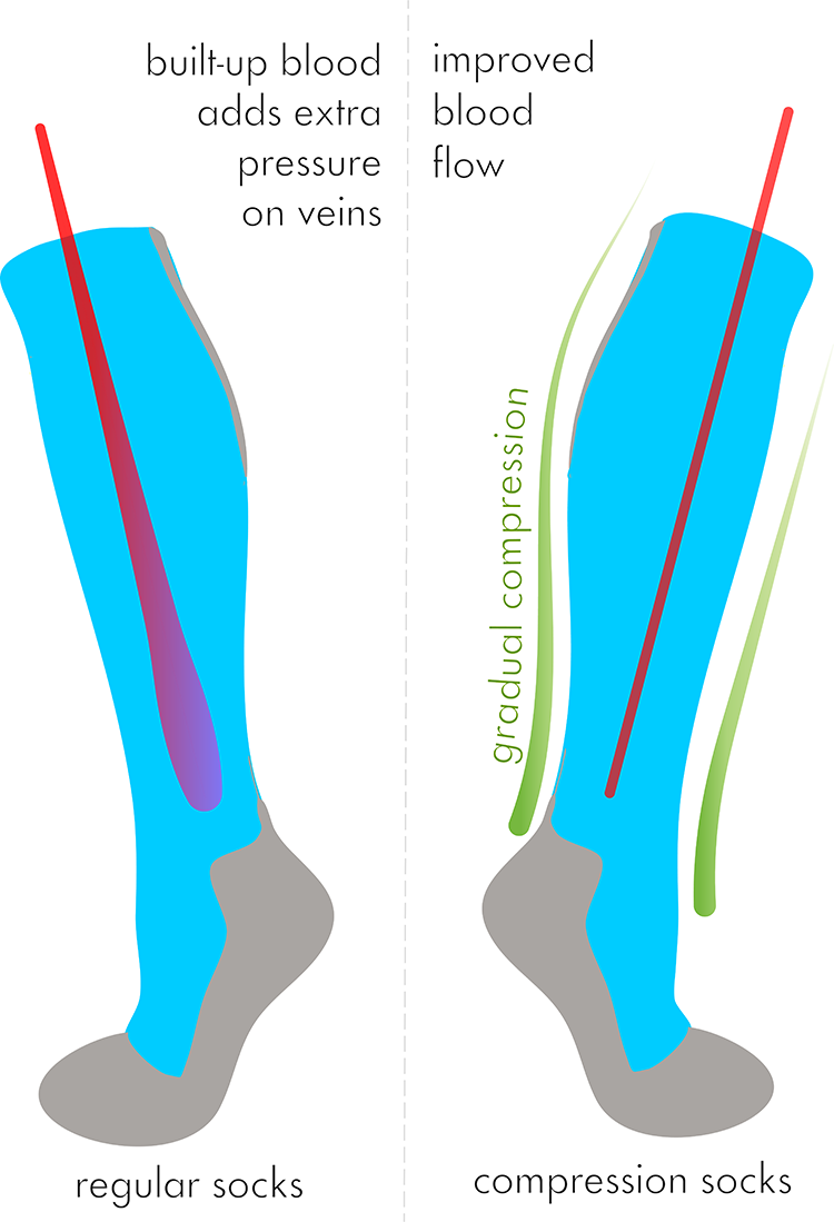 Compression Socks Vs. Regular Socks — A Brief Comparison by JT Tobin