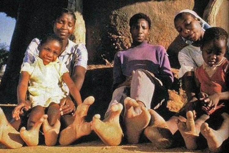 Face like a man and legs of an ostrich, the story of this community is mysterious! Feet have only 2 toes...