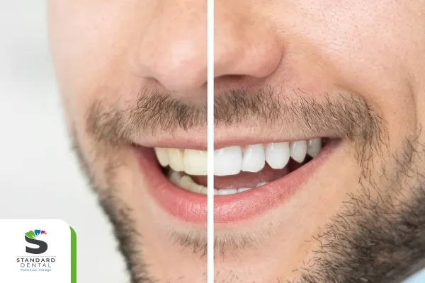 Results Depend on Your Habits