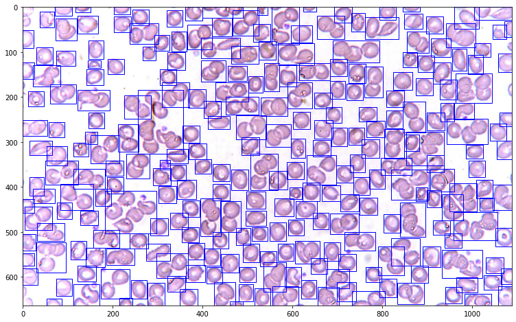 Spot the blob on the job: Image Detection, Labeling, and Measurement ...