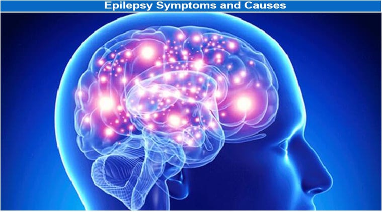 epilepsy symptoms