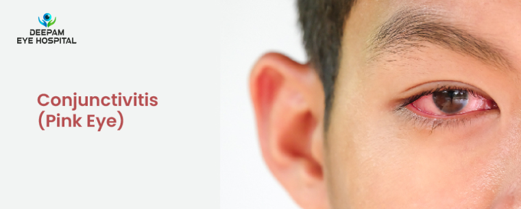 Pink Eye Conjunctivitis Causes Symptoms and Home Remedies