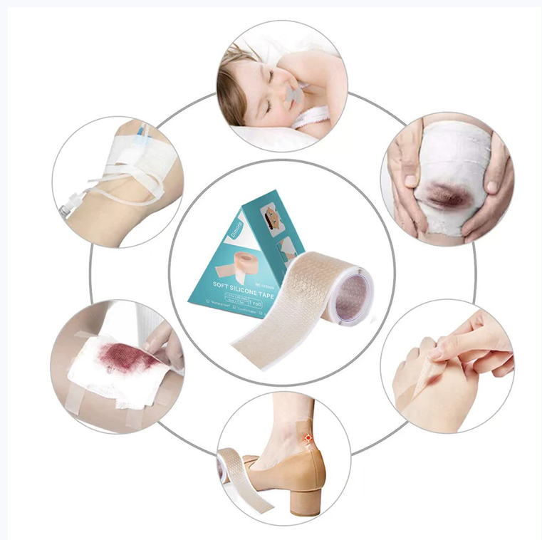 How Do Scar Tapes Work on Scars?. The silicone scar patch consists of a