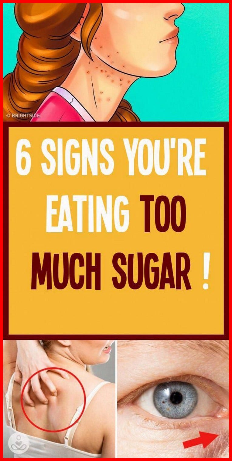Signs You Are Eating Too Much Sugar! healthystyle Medium