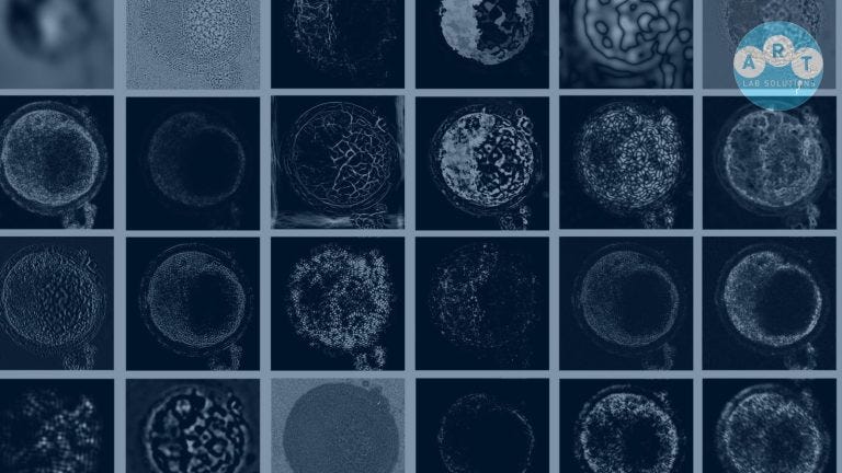 Excitement vs. pragmatism: Where does AI sit within cattle IVF embryology?