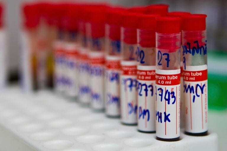 The Value of Creatine Kinase Serum Samples in Translational Research