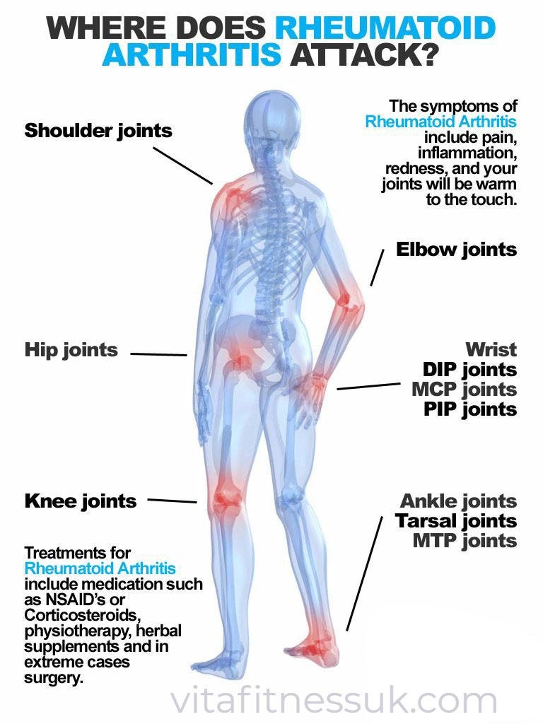Rheumatoid Arthritis Signs and Symptoms that you don’t Ignore by