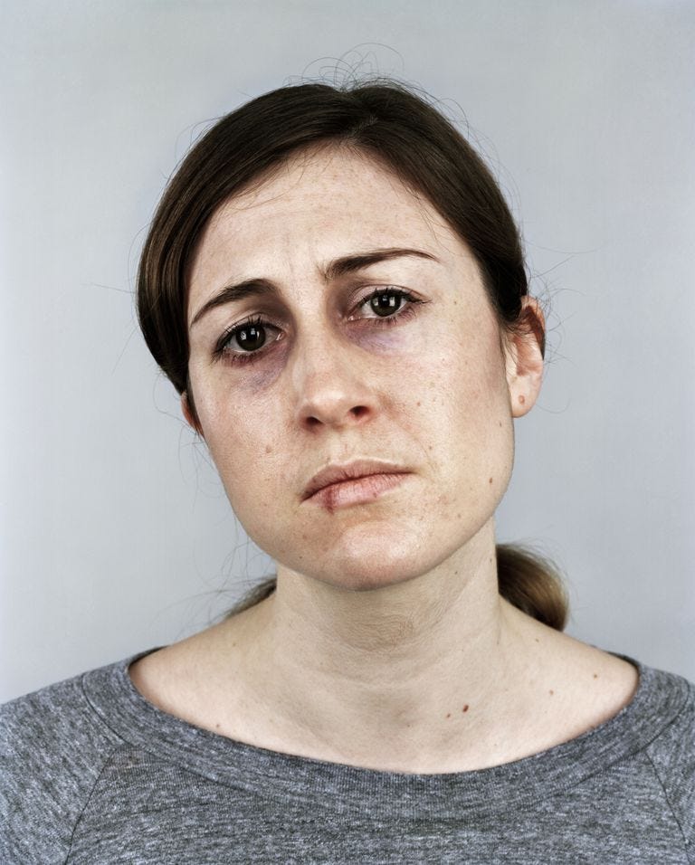 Forms of Dysautonomia. A professor of surgery and pediatrics… by Mark