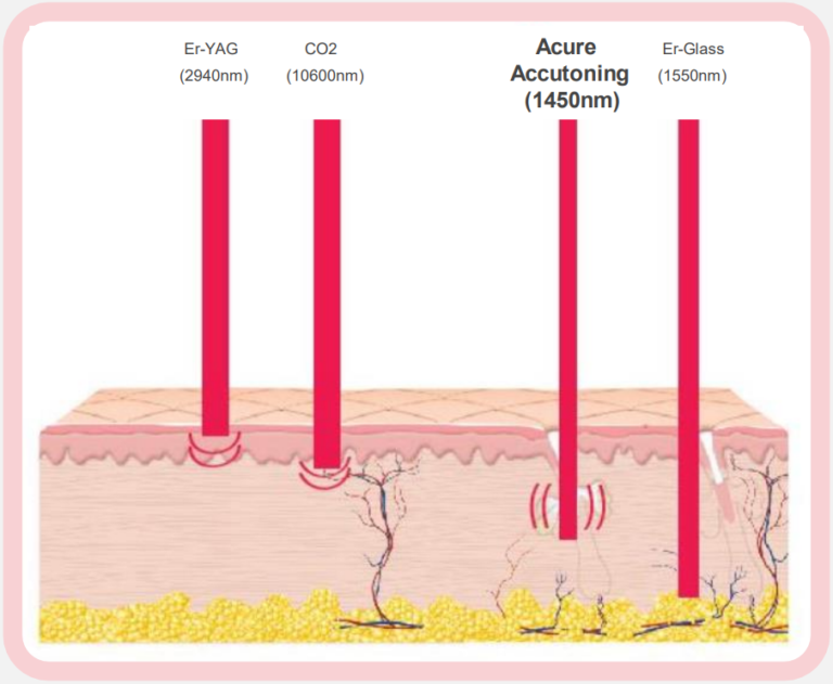 Laser Diode Decoded