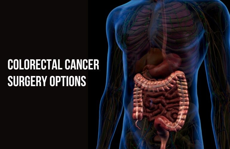 Surgical options for colorectal cancer what to expect before, during