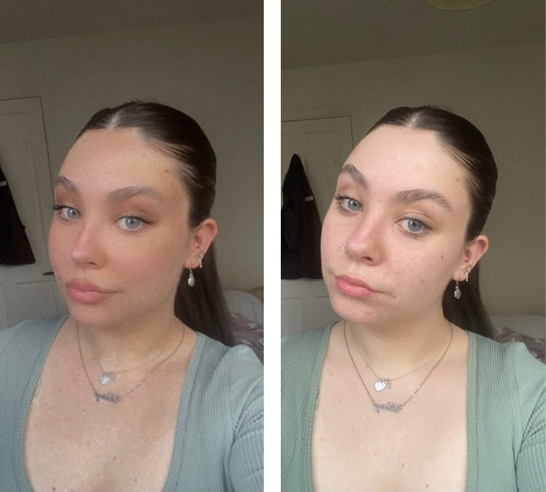 Instagram filters — a oneway ticket to body dysmorphia? by Daisy