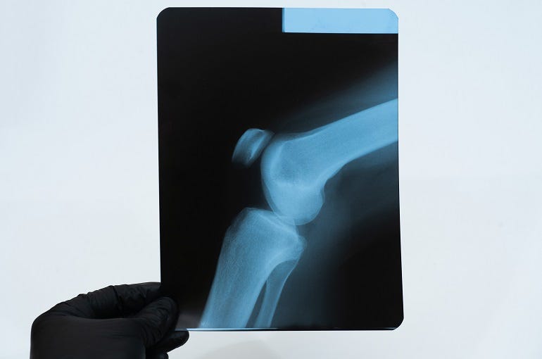 The Importance of XRays for Knee and Leg Injuries by Sumitz Clinic