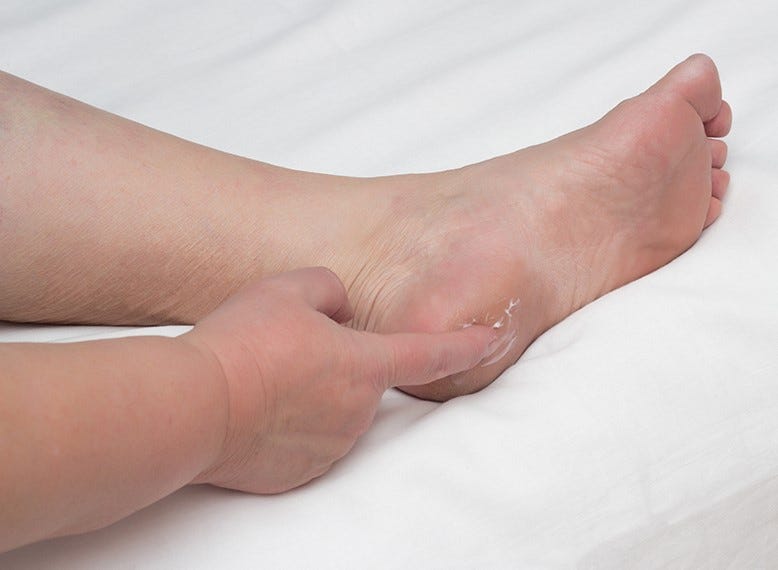 Comprehensive Wound Care Near Me Ensuring Swift Healing and Wellness