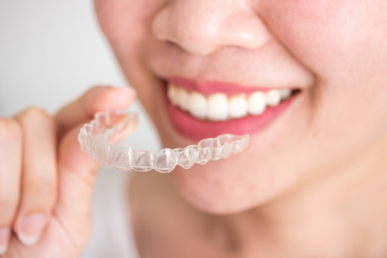 INVISALIGN IN IN KALYANI NAGAR PUNE by braces smiles Medium