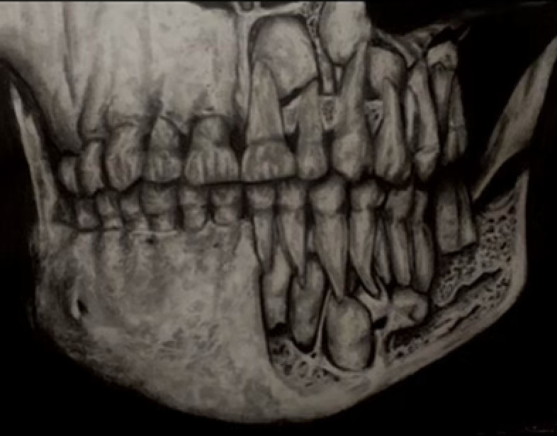 Tooth Sketch - Natasha Jain - Medium