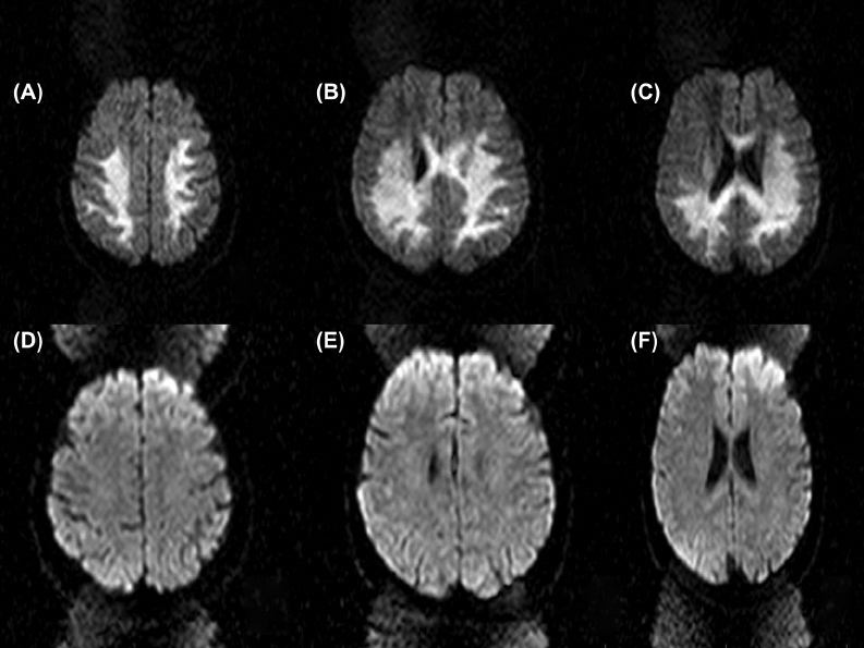 Google搜尋關鍵字:the first image of MRI, July 3, 1977(圖片來源:researchgate.net)