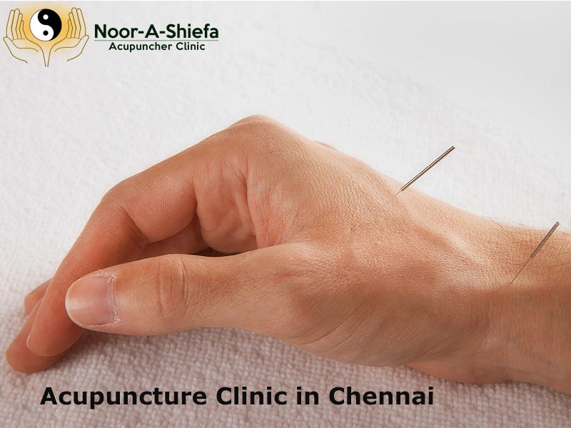 Acupuncture Clinic in Chennai. We at Noor A Shiefa Acupuncture Clinic