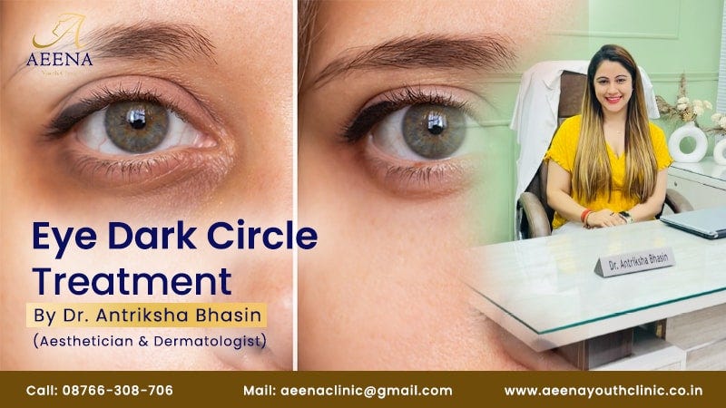 Professional Treatments for Dark Circles Under Eyes