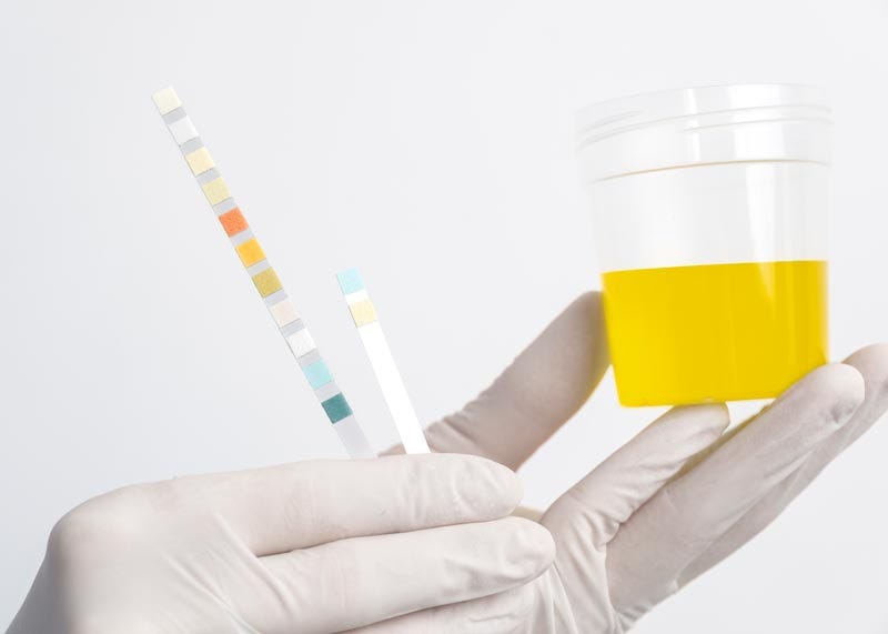 can a urine test detect stds by Stace fox Jun, 2024 Medium