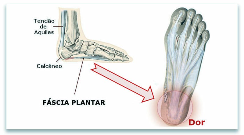 DICAS PARA QUEM FICA MUITO TEMPO EM PÉ OU SENTADO - Blog Meu Pé de Conforto