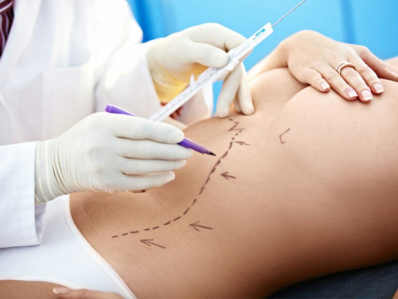 Is Liposuction Right for You? Consultations in Riyadh