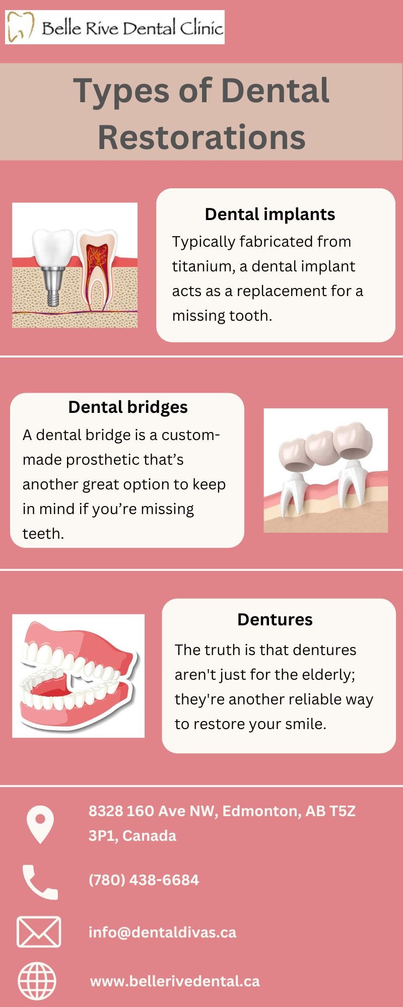 Types of Dental Restorations Belle Rive Dental Clinic Medium