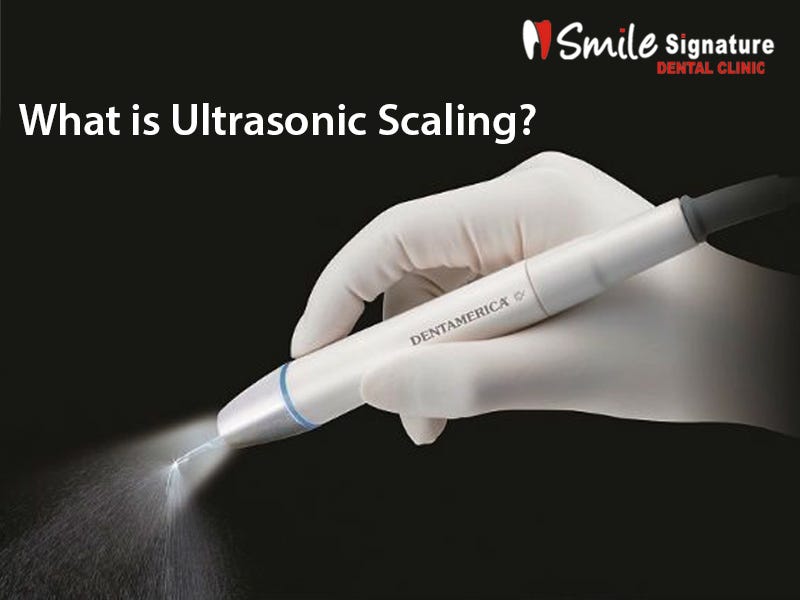 What is Ultrasonic Scaling?. Before we start talking about… by Rahid