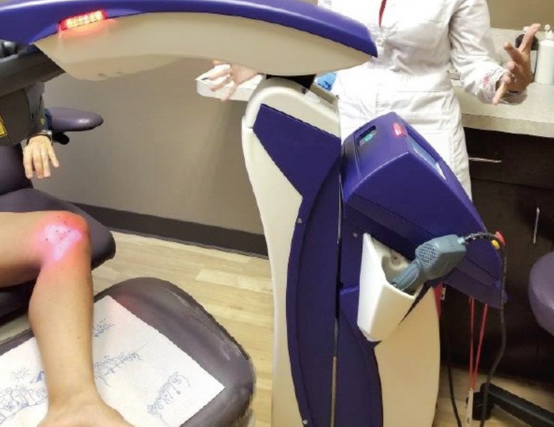 LASER THERAPY IN NEW RICHMOND. How does Laser Therapy work? by Spine