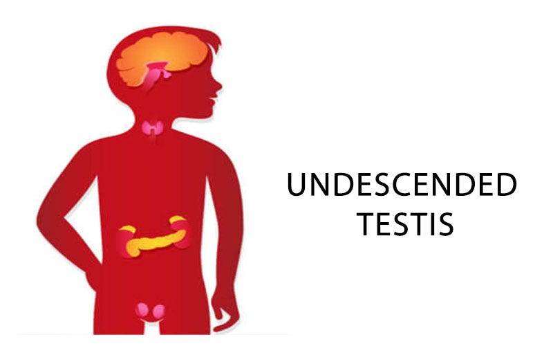 What is an undescended testis? Drbhaveshdoshi Medium