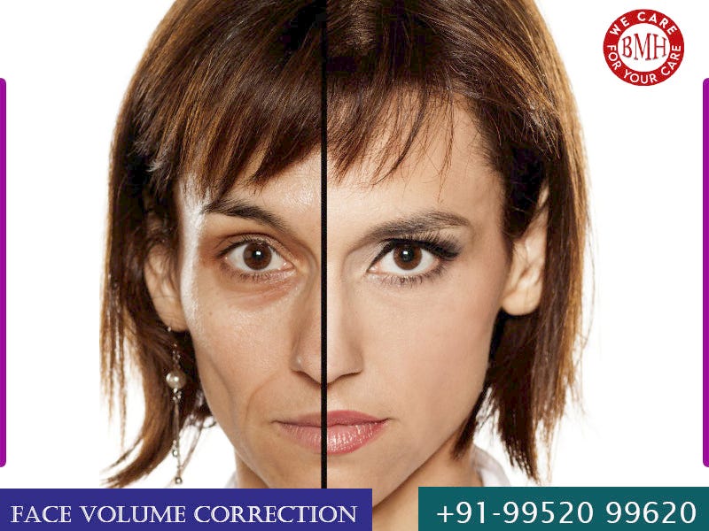 Under Eye Dark Circles Removal In Chennai by Rkonemarketing Medium