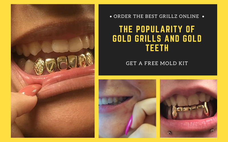 Gold Teeth Molding Kit 