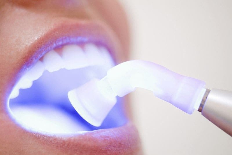Laser Gum Treatment for Bleeding Gums: How Effective Is It?