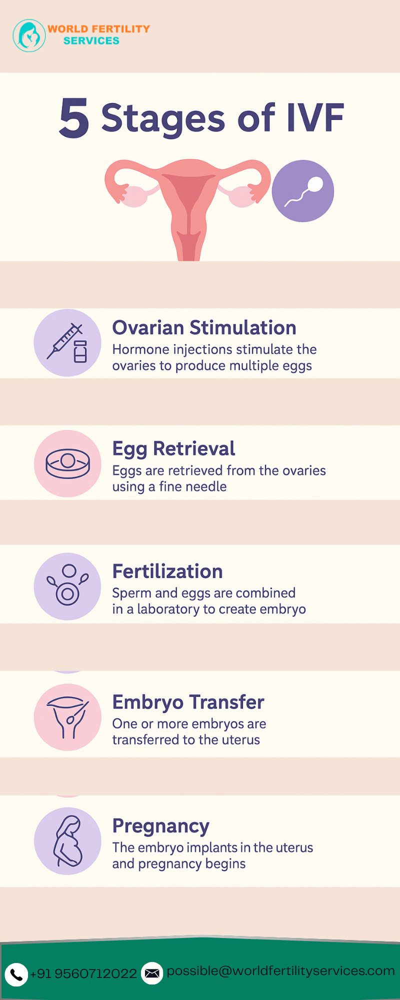 5 Stages of IVF