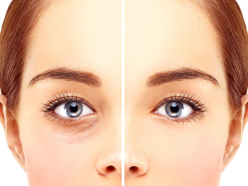 Does Medicare cover Eyelid Surgery? by best clinic Medium