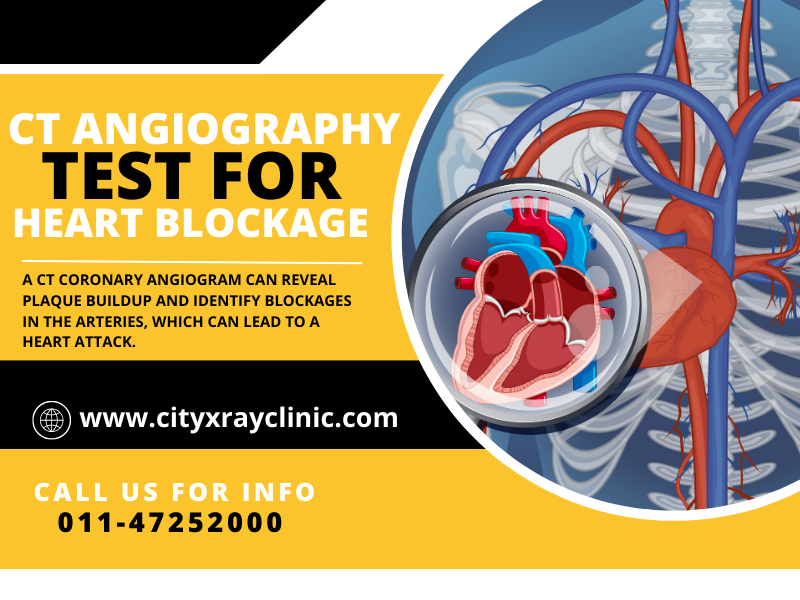 CT Coronary Angiography Price Guide Quick Cost Insight