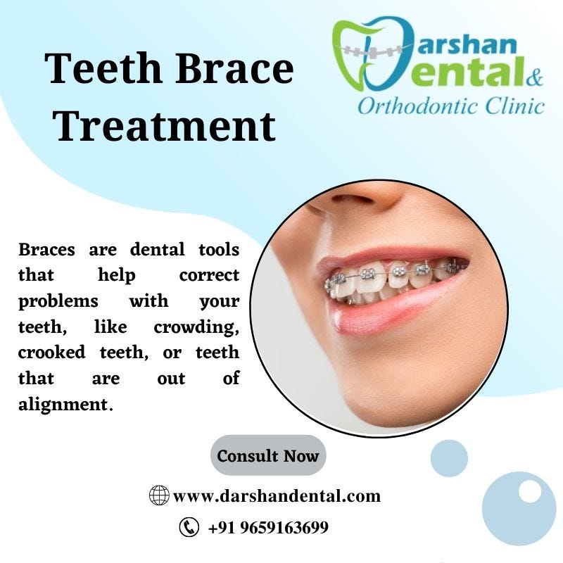 Best Teeth Braces Treatment Kanyakumari Teeth Braces Treatment