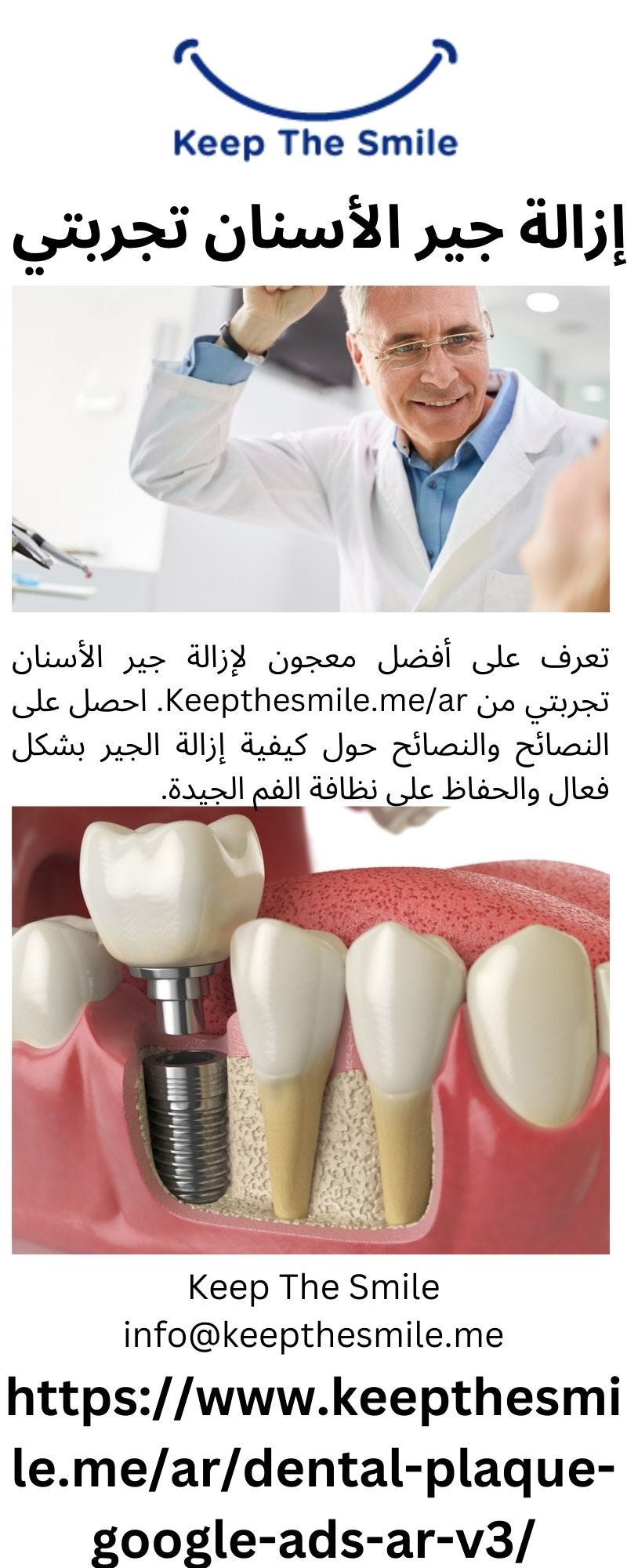 إزالة جير الأسنان تجربتي - Keepthesmile - Medium