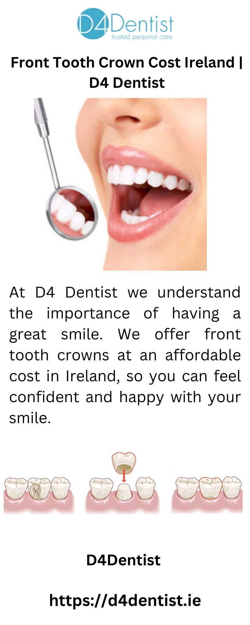 Front Tooth Crown Cost Ireland D4 Dentist Ddentist Medium