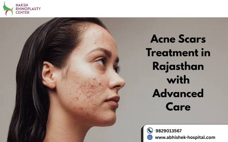 Acne Scars Treatment in Rajasthan with Advanced Care