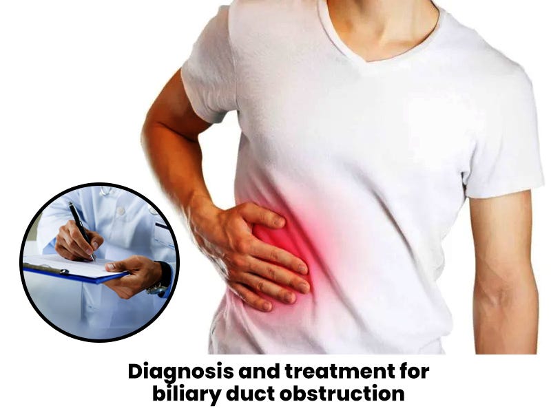 Diagnosis and treatment for biliary duct obstruction by Sanat Haldar