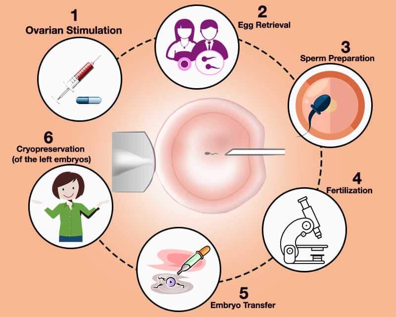what-is-icsi-a-detailed-guide-to-intracytoplasmic-sperm-injection-by