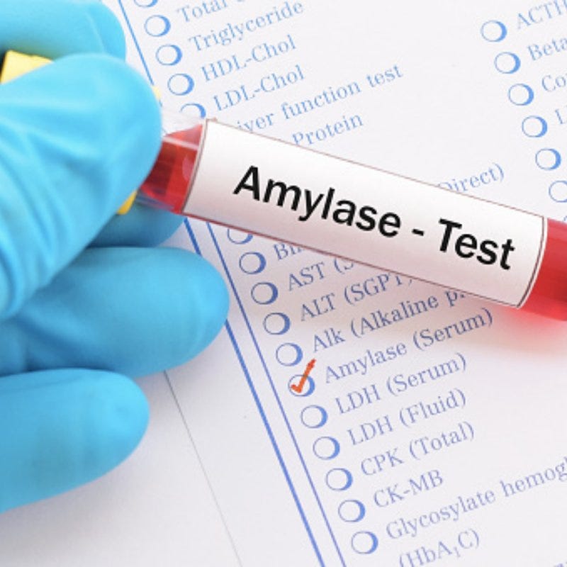 Amylase Test. An amylase test may be ordered if your… by Newera