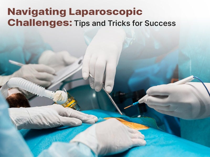 Navigating Laparoscopic Challenges: Tips and Tricks for Success