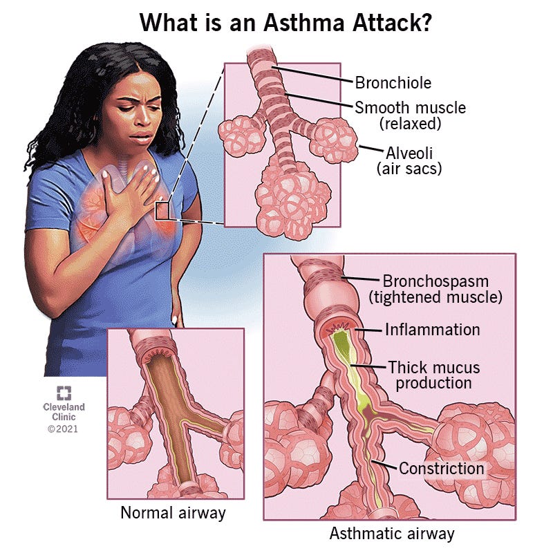 Respiratory Disorders How to identify and Treat Asthma, Emphysema and Bronchitis by soumya