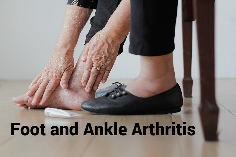 Signs of Foot and Ankle Arthritis Symptoms and Treatment Options by